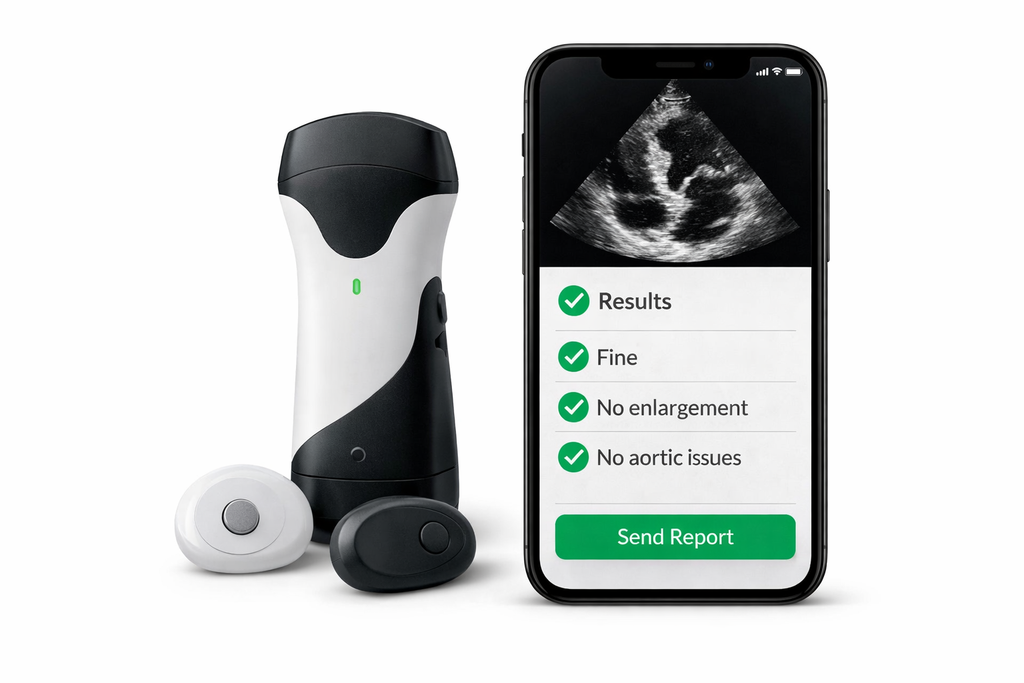 IHeartSense DX - INFANT - Pre Order Now For mid-September 2026